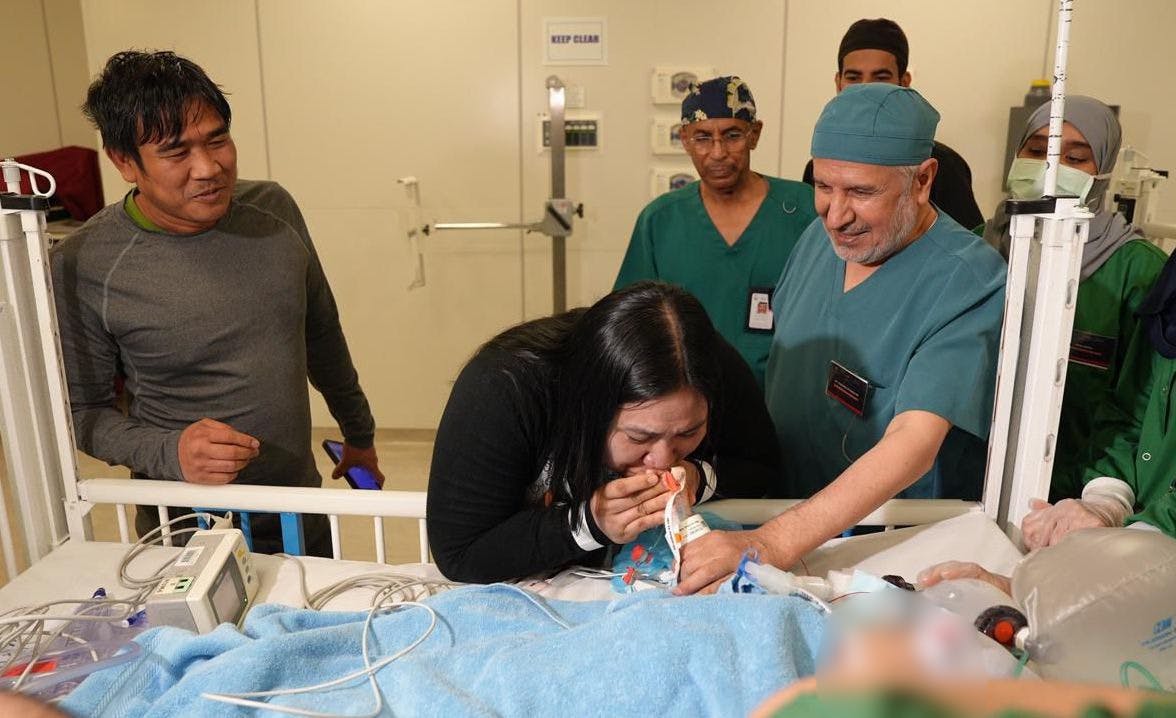 Filipino Conjoined Twins Separated In Saudi