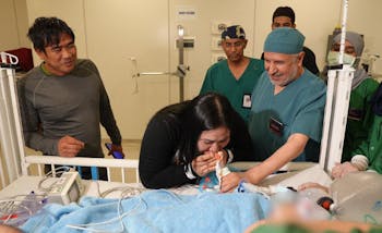 Filipino Conjoined Twins Separated In Saudi