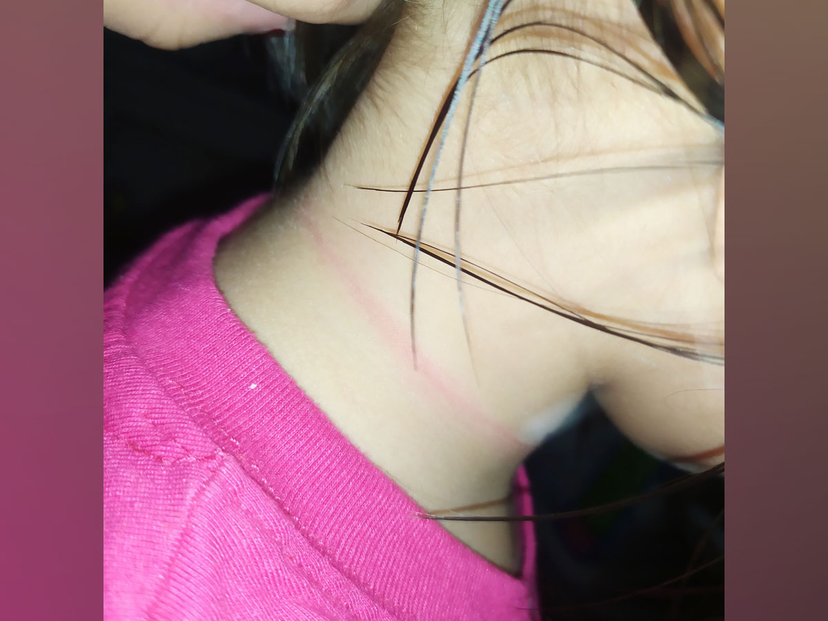 4-Year-Old Filipina Copies Dangerous TikTok, Almost Loses Life