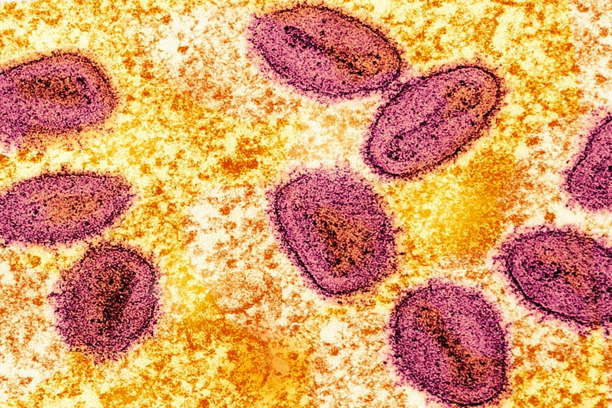 DOH Detects 2 More Mpox Cases In Metro Manila