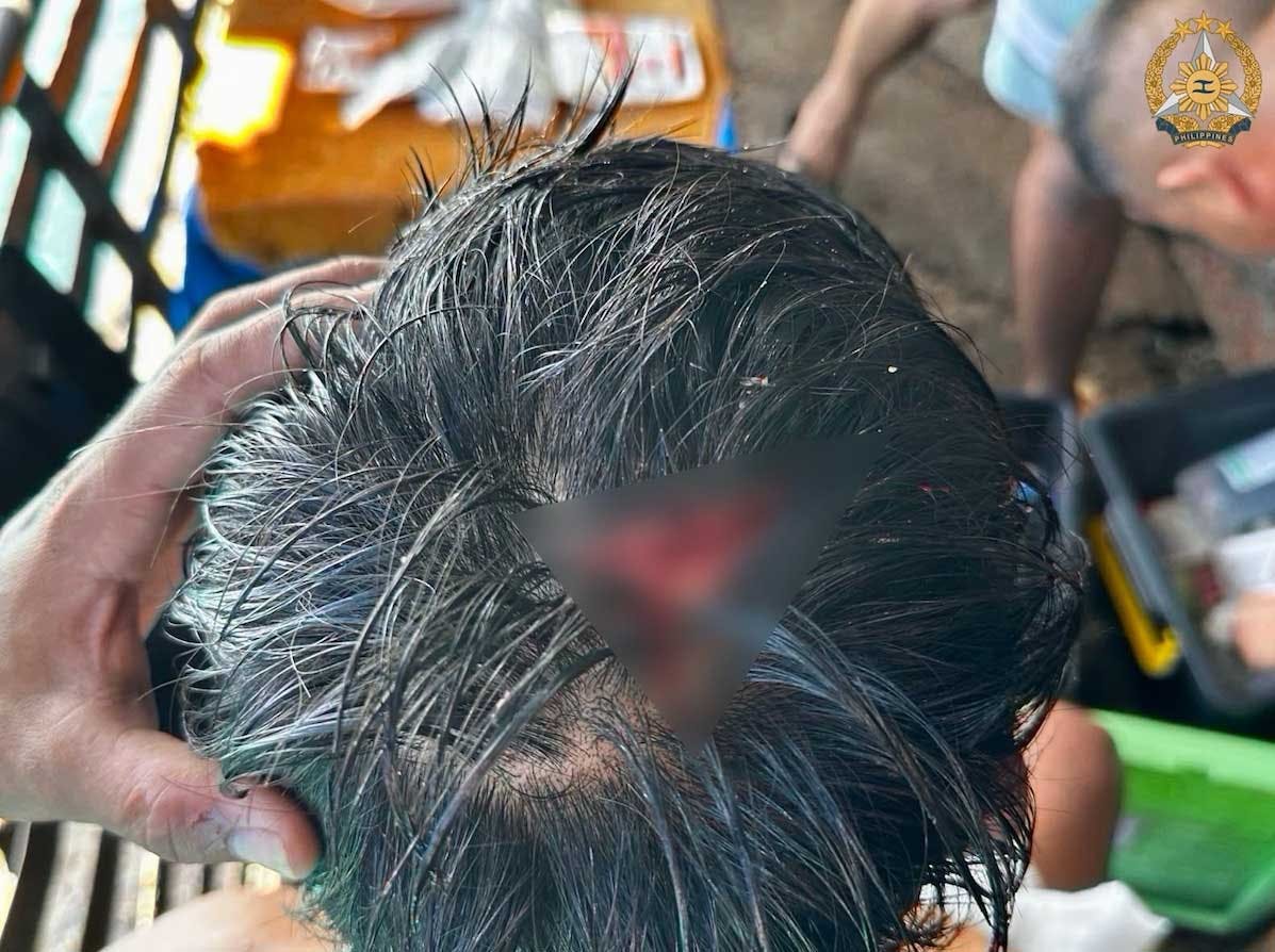 Philippine Navy Personnel Hurt In China Coast Guard Baton Attack
