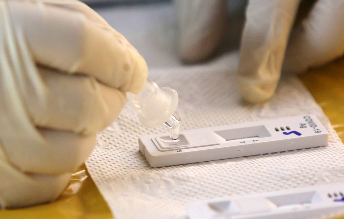 ‘Actual Number Of COVID-19 Cases Higher Than What Is Reported’